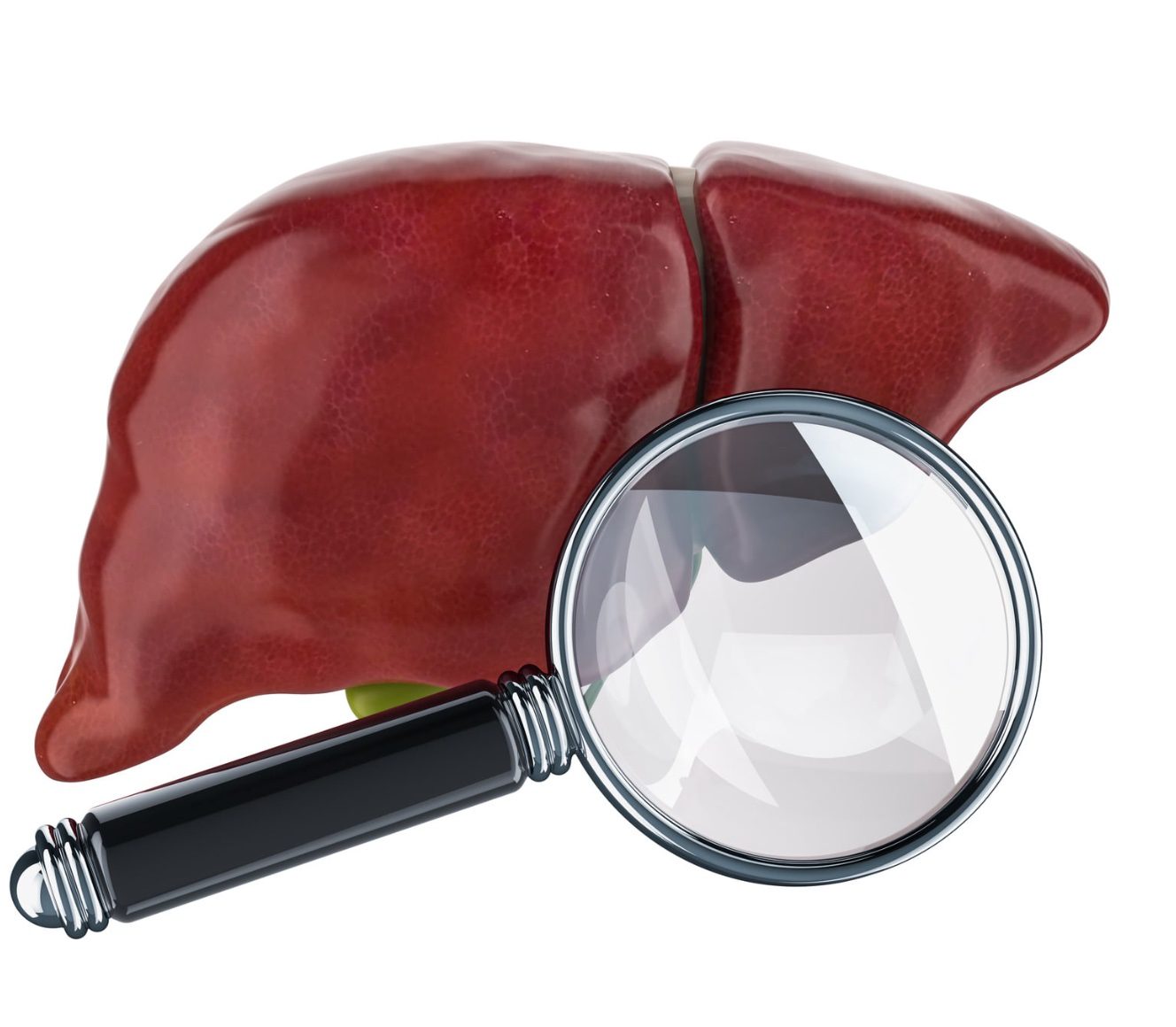 diagnostico del cancer de higado