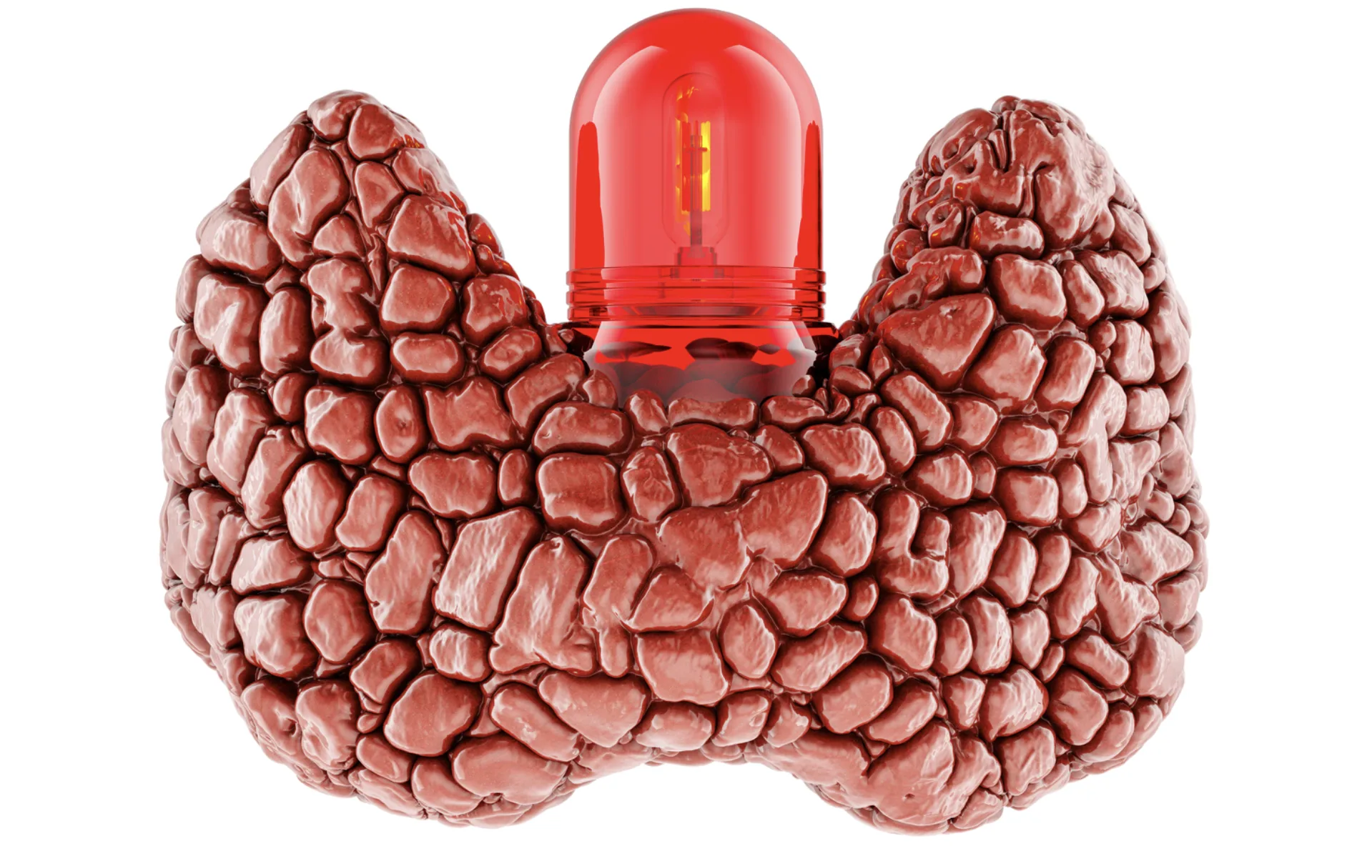 cancer de tiroides o nodulos tiroideos